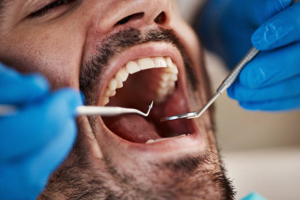 Best Walk-In Emergency Dentist in Colby, KS